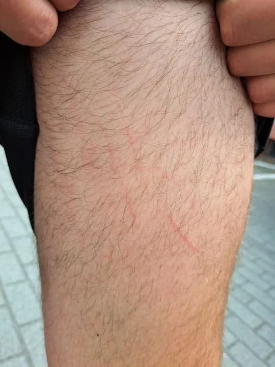 Niebezpieczna sytuacja z okolic Jarocina. Trzy owczarki rzuciły się na spacerującego z psem — zdjęcie 2 z 4