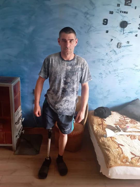 Rafał Mielcarek z Hilarowa ma nową nogę. Teraz musi nauczyć się chodzić z protez — zdjęcie 3 z 3