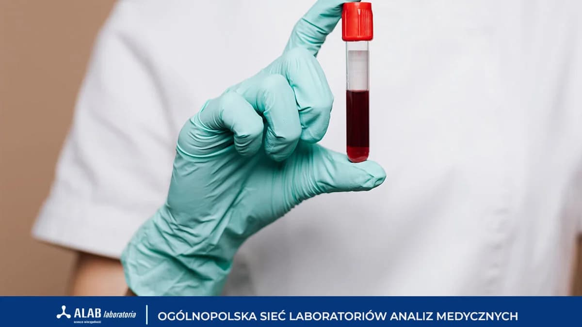 Morfologia – podstawowe badanie, które może uratować życie