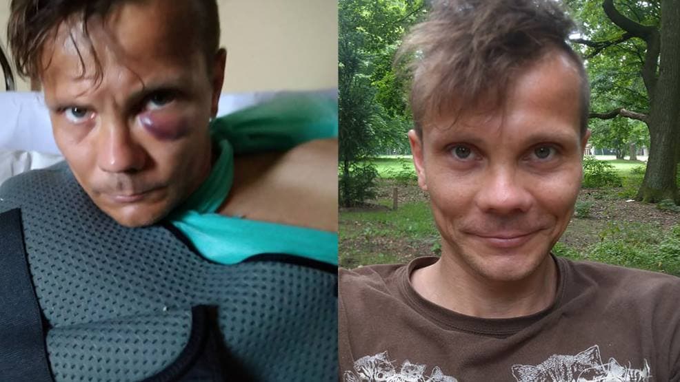 Przyjechał na festiwal. Leży połamany w szpitalu. Pobiła go ochrona? Sprawę wyjaśnia policja
